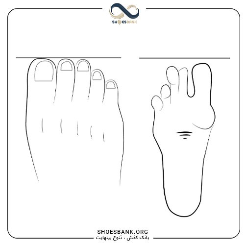 مدل پای رومی